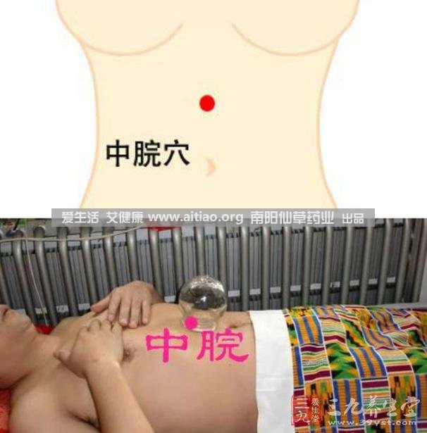 中脘穴位于腹部正中線，臍上4寸的位置上。每天艾灸10-15分鐘，能有效緩解胃部不適的癥狀，同時(shí)有助于祛濕。